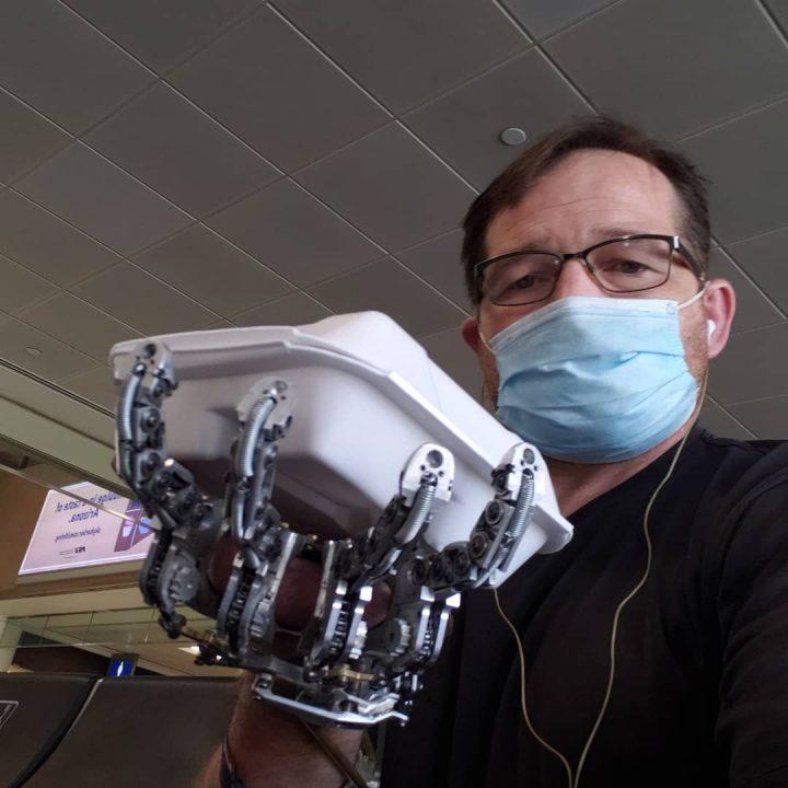 [Посмотрите] Блог инженера, который делает бионический протез для себя