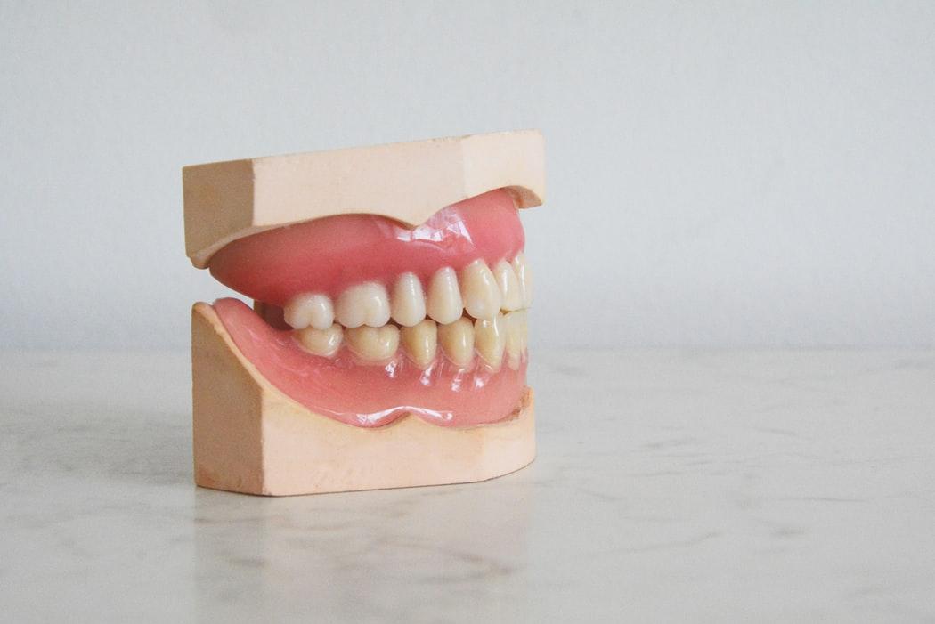 [Изобрели] умные зубные импланты