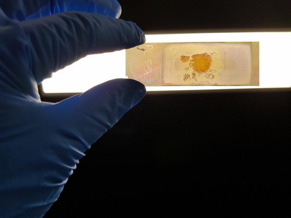 Новое стекло для микроскопа помогает быстро находить раковые клетки