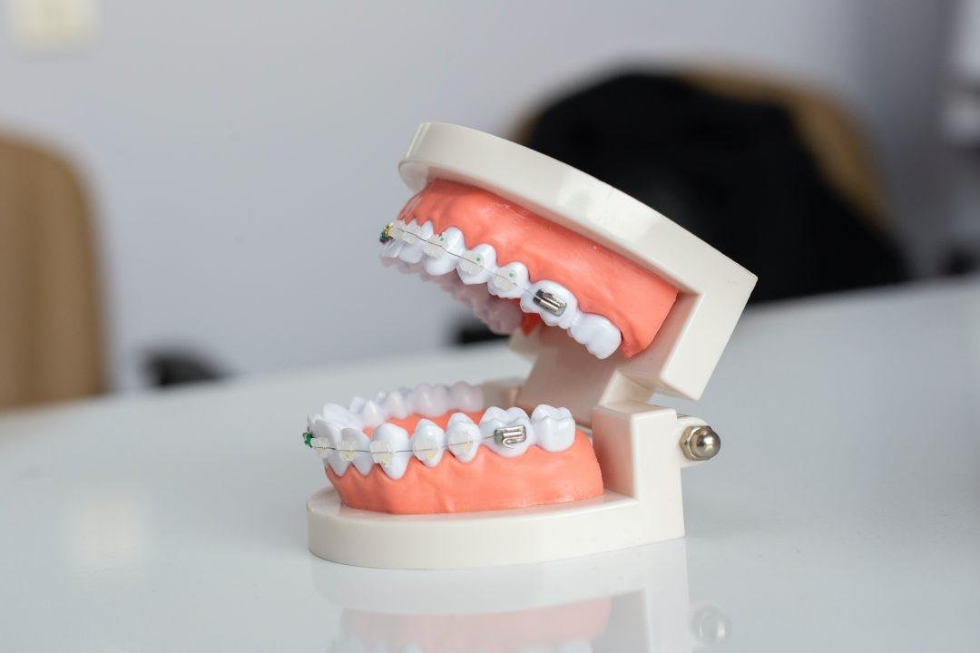Сделали систему микророботов для автоматической чистки зубов