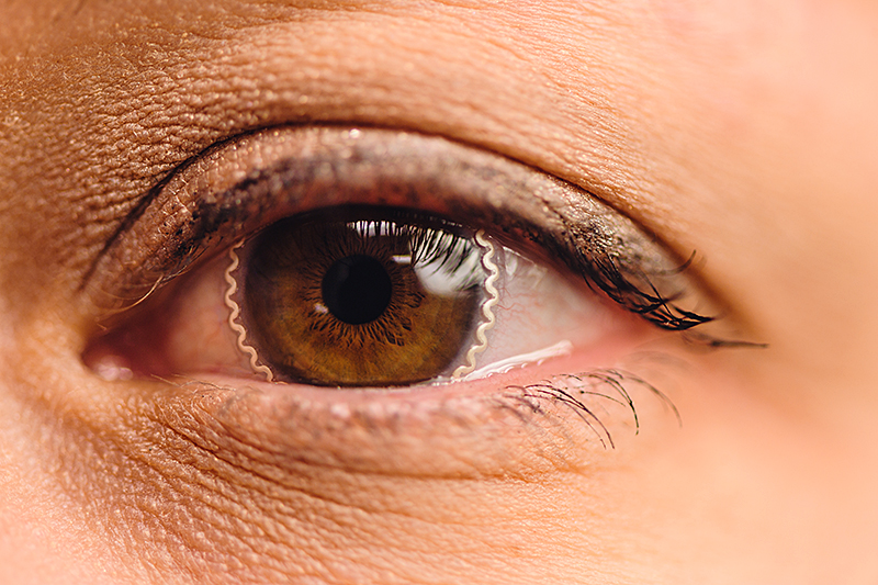 Сделали мягкие контактные линзы для выявления глаукомы и замедления её развития