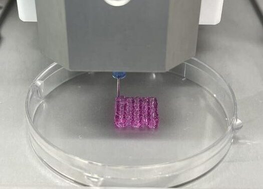 Придумали, как удалять раковые клетки с помощью 3D-биопечати